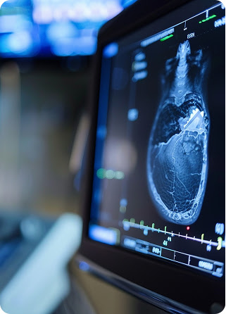 Coronary calcium scan on a medical monitor